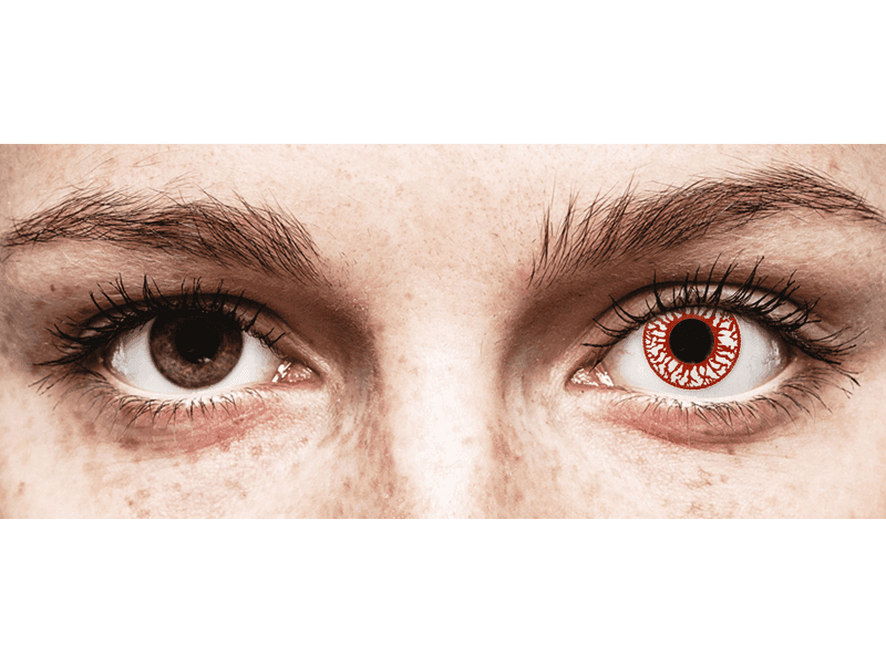 SCLERAL LENS TROUBLESHOOTING FAQs